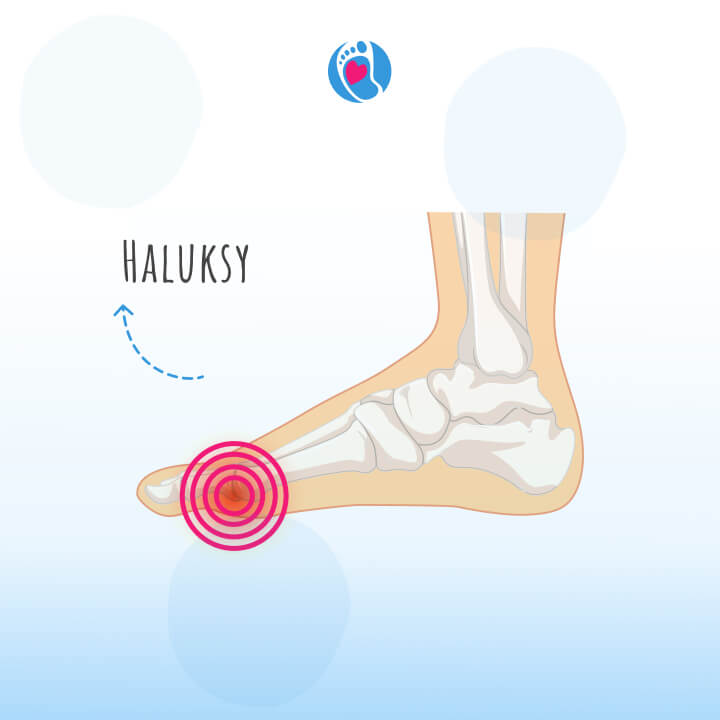 haluksy-paluch-koslawy-blog-jak-wybrac-buty-barefoot-dla-doroslej-stopy-bosa-stopka-sklep-z-butami-dzieciecymi-butami-barefoot haluksy-paluch-koslawy-blog-jak-wybrac-buty-barefoot-dla-doroslej-stopy-bosa-stopka-sklep-z-butami-dzieciecymi-butami-barefoot