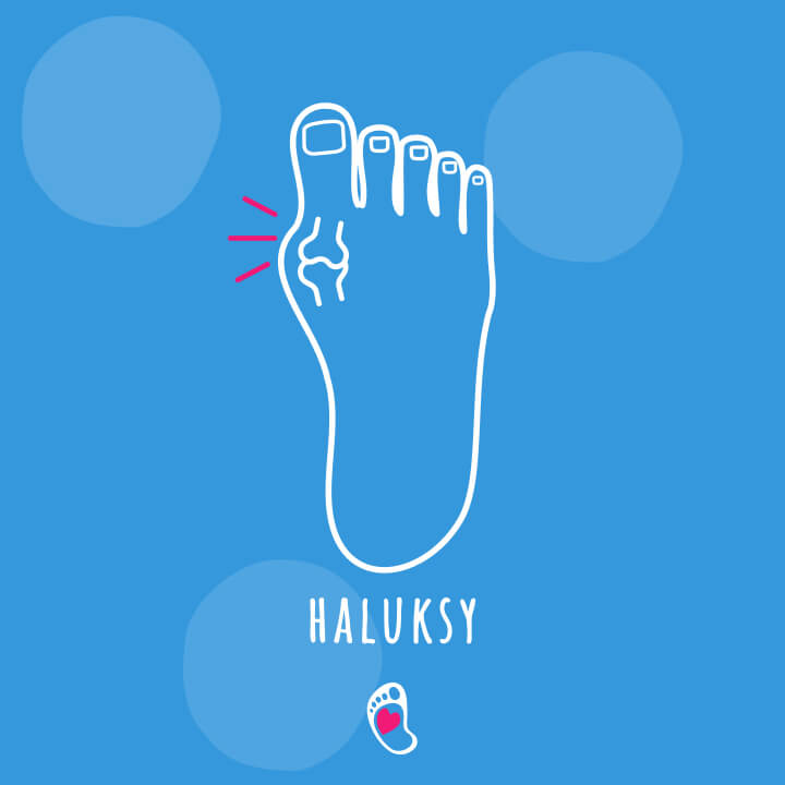 haluksy-paluch-koslawy-blog-jak-wybrac-buty-barefoot-dla-doroslej-stopy-bosa-stopka-sklep-z-butami-dzieciecymi-butami-barefoot