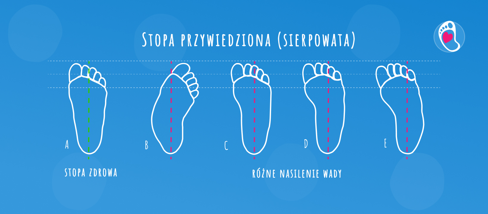 stopa-przywiedziona-sierpowata-blog-jak-wybrac-buty-barefoot-dla-doroslej-stopy-bosa-stopka-sklep-z-butami-dzieciecymi-butami-barefoot stopa-przywiedziona-sierpowata-blog-jak-wybrac-buty-barefoot-dla-doroslej-stopy-bosa-stopka-sklep-z-butami-dzieciecymi-butami-barefoot