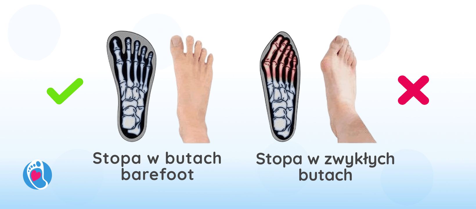 porownanie-stopa-w-butach-barefoot-stopa-w-klasycznych-butach-Badania-naukowe-trendy-buty-damskie-meskie-wplyw-na-deformacje-stop-bosa-stopka-sklep-z-butami-barefoot. porownanie-stopa-w-butach-barefoot-stopa-w-klasycznych-butach-Badania-naukowe-trendy-buty-damskie-meskie-wplyw-na-deformacje-stop-bosa-stopka-sklep-z-butami-barefoot.