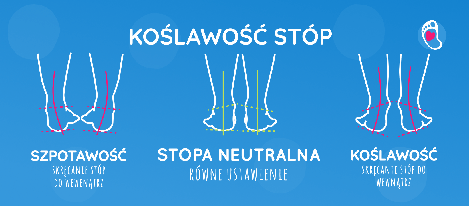 Koślawość-stóp-buty-barefoot-Bosa-Stopka Koślawość-stóp-dziecka-jak-wybrać-buty-barefoot-Bosa-Stopka