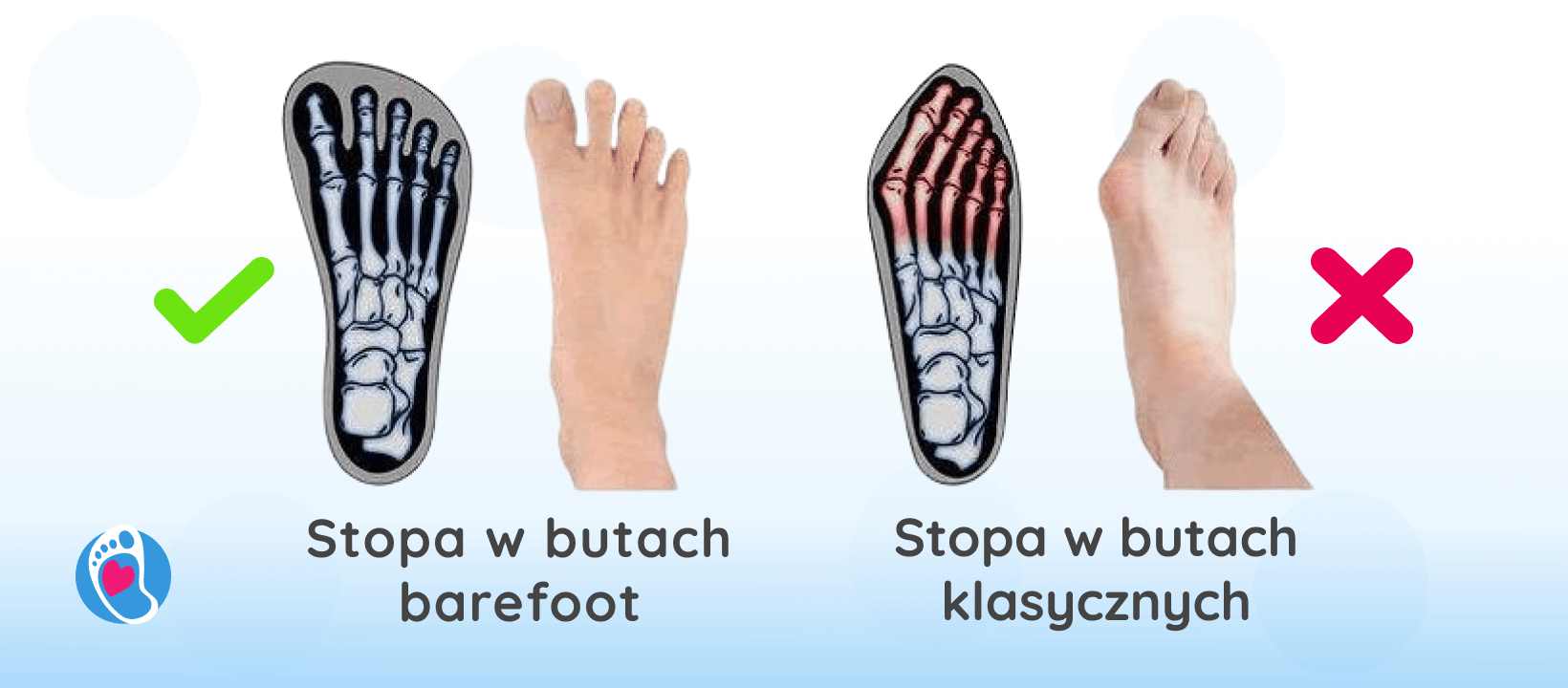 /stopa-w-butach-barefoot-vs-stopa-w-klasycznych-butach-czym-sa-haluksy-paluch-koslawy-bosa-stopka-sklep-z-butami-dla-dzieci-barefoot /stopa-w-butach-barefoot-vs-stopa-w-klasycznych-butach-czym-sa-haluksy-paluch-koslawy-bosa-stopka-sklep-z-butami-dla-dzieci-barefoot