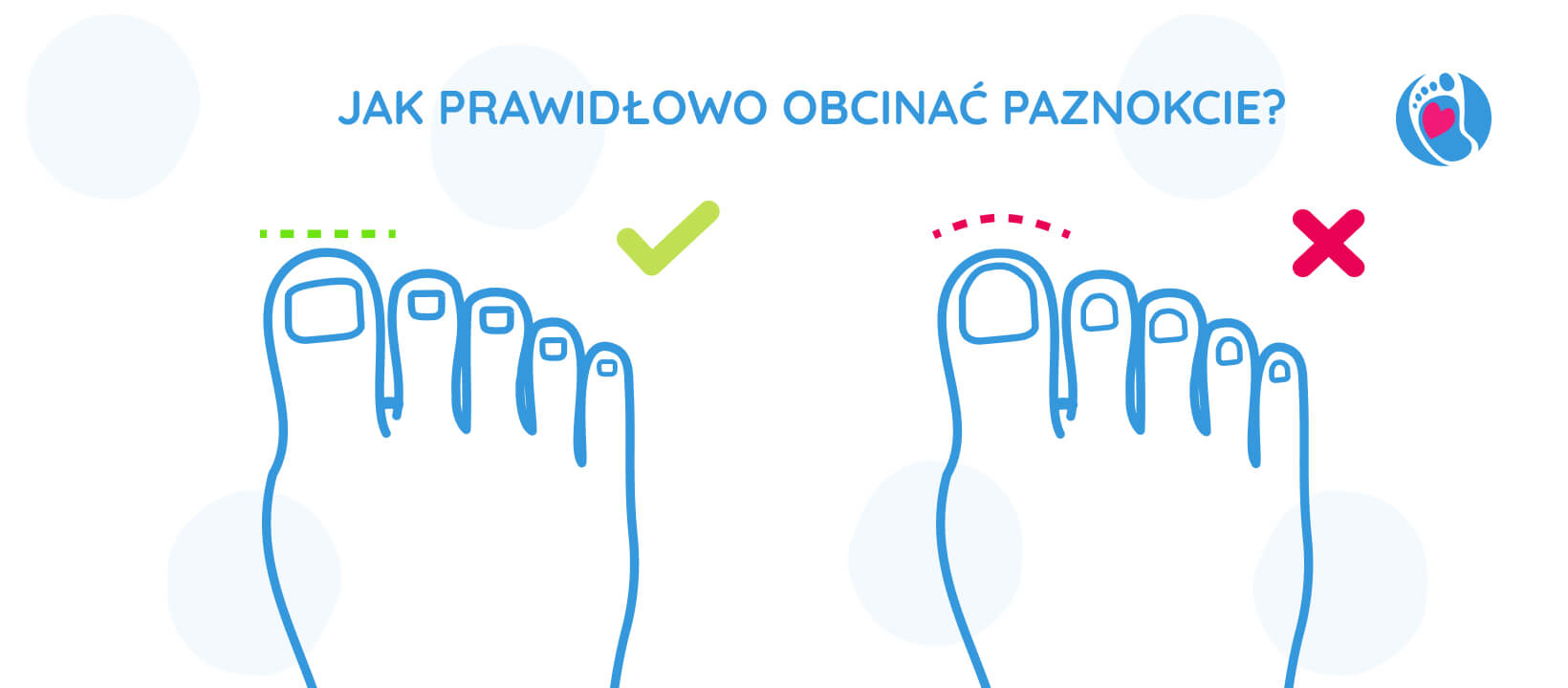 jak-prawidlowo-obcinac-paznokcie-okiem-eksperta-sylwia-purzynska-zmiana-plytki-paznokciowej/stopa-w-klasycznych-butach-vs-stopa-w-butach-barefoot-bosa-stopka-sklep okiem-eksperta-sylwia-purzynska-zmiana-plytki-paznokciowej/stopa-w-klasycznych-butach-vs-stopa-w-butach-barefoot-bosa-stopka-sklep