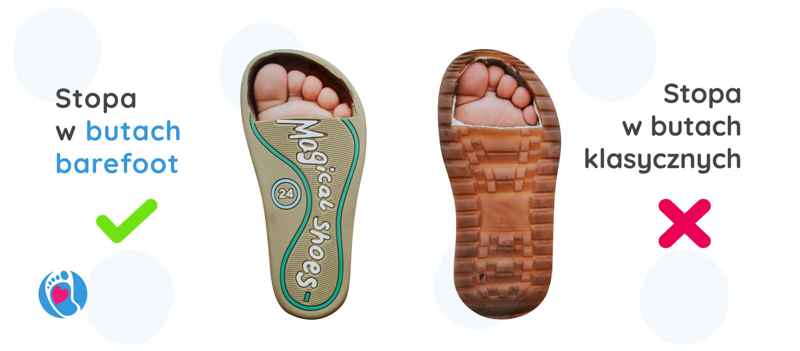 okiem-eksperta-sylwia-purzynska-zmiana-plytki-paznokciowej/stopa-w-klasycznych-butach-vs-stopa-w-butach-barefoot-bosa-stopka-sklep okiem-eksperta-sylwia-purzynska-zmiana-plytki-paznokciowej/stopa-w-klasycznych-butach-vs-stopa-w-butach-barefoot-bosa-stopka-sklep